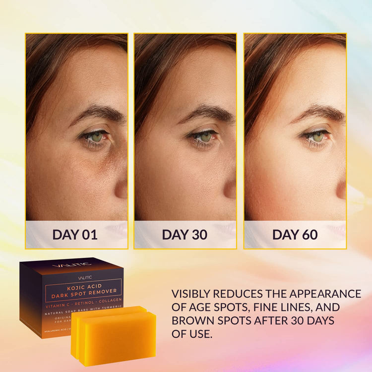 Dark Spot Remover Soap